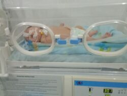 Bayi Lahir Tanpa Anus di Manggarai Butuh Uluran Kasih untuk Biaya Operasi