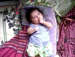 Bayi di Manggarai Lahir Tanpa Lubang Anus Butuh Biaya Operasi